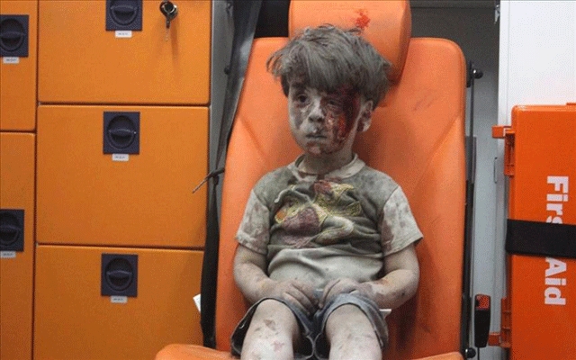 هذه حقيقة الطفل السوري عمران العائد من الموت.. (مع فيديو)